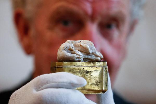 NBA球星帕克賽季報銷原因及其對球隊影響的分析