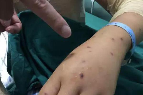 Woj：克里斯蒂計劃和湖人簽4年3200萬美元的續(xù)約合同 含球員選項