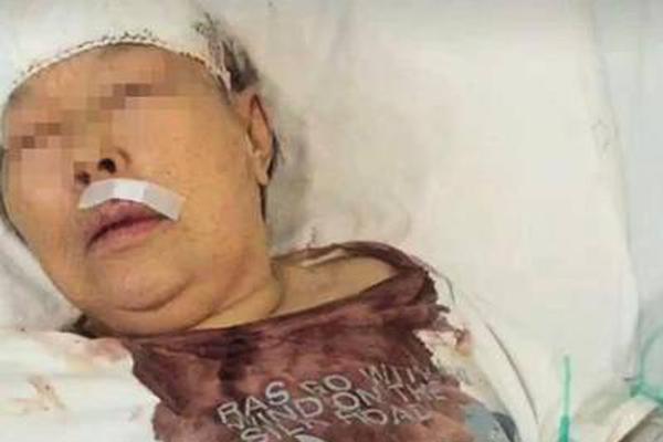 喬治：我與亞裔社區(qū)同在，我與他們站在同一戰(zhàn)線