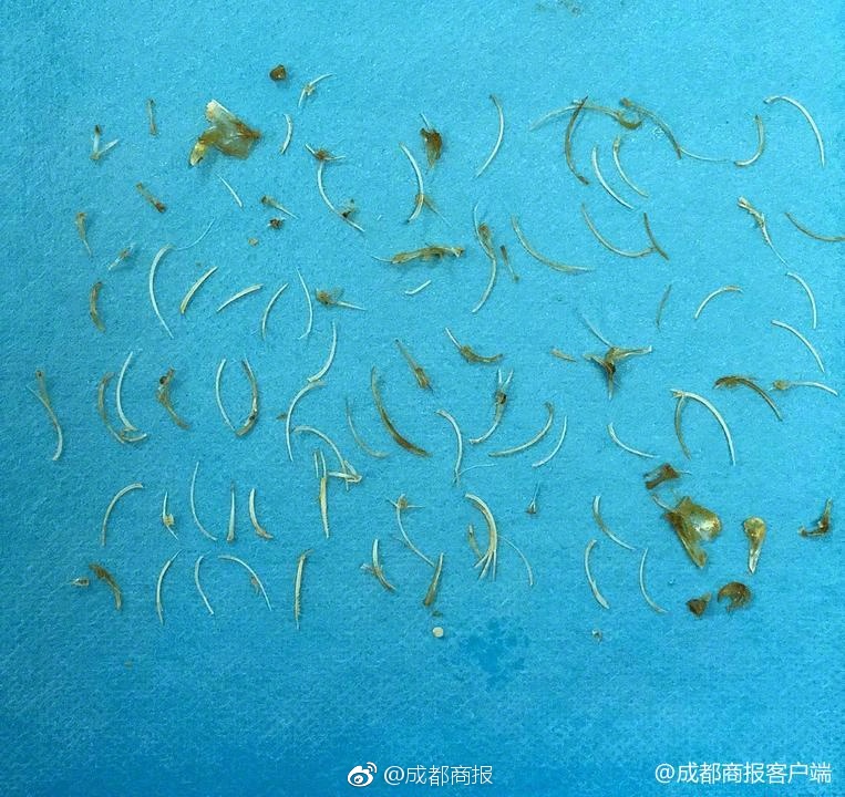 史蒂文斯：對陣籃網咱們或許得砍下110